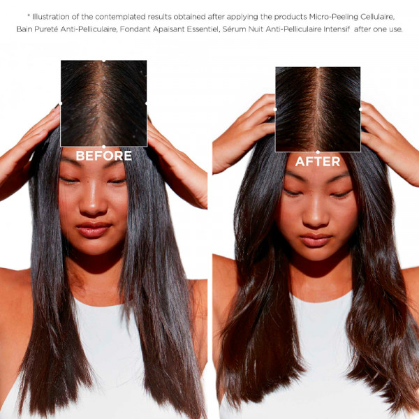 symbiose-bain-purete-anti-pelliculaire-anti-skael-shampoo