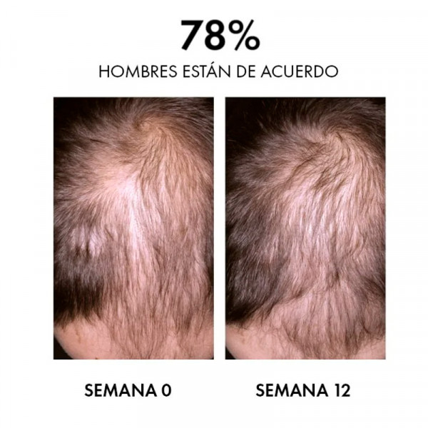 dercos-aminexil-clinical-regen-booster-serum-capilar
