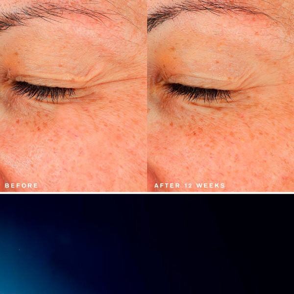 advanced-night-repair-eye-lift-sculpt-opstrammende-ojenkonturbehandling