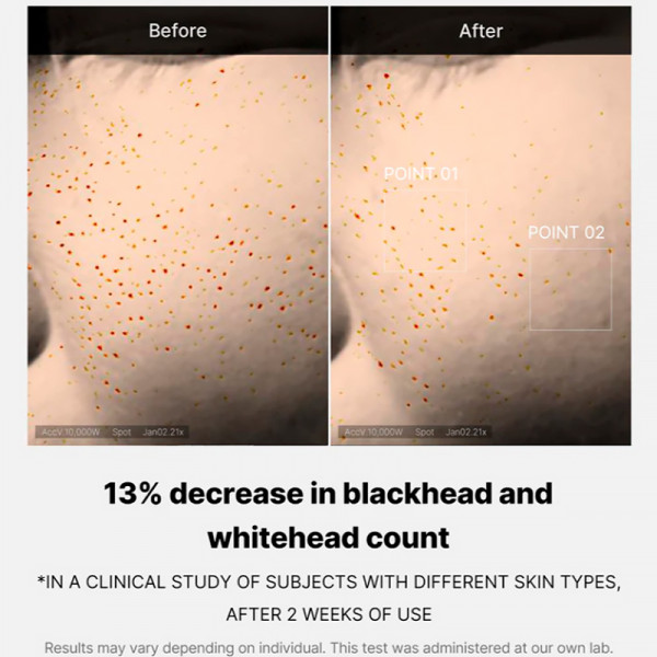 zero-pore-one-day-serum-exfoliating-facial-serum-cleanser