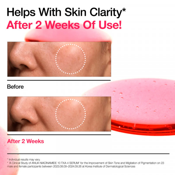 niacinamide-10-txa-4-serum-intensives-serum-gegen-pigmentflecken-und-fur-einen-strahlenden-teint