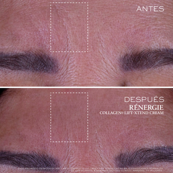 renergie-collagen-lift-xtend-facial-cream-with-collagen