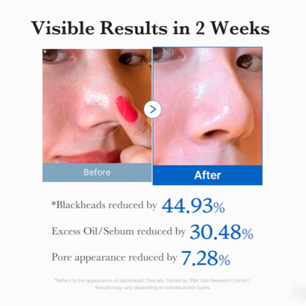 zero-pore-pads-peelingscheiben