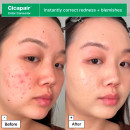 cicapair-redness-rescue-set