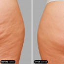 unicbody-slim-action-x4-tratamento-corporal-tonificante