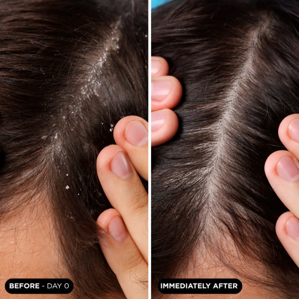 the-scalp-scrub-hair-exfoliant