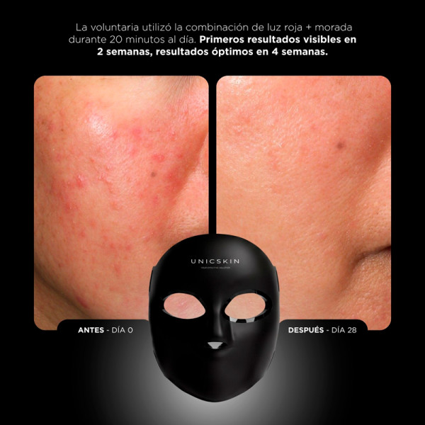 unicled-50-centurion-appareil-de-traitement-du-visage
