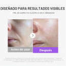 booster-pro-mini-tecnologia-per-la-cura-del-viso