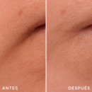genifique-repair-shot-wrinkle-correcting-treatment