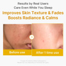 kojic-acid-turmeric-wrapping-mask-verhelderend-nachtgezichtsmasker