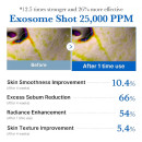 zero-exosome-shot-gezichtsserum-met-spikes