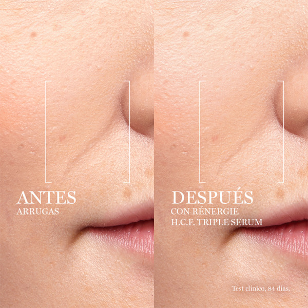 Rénergie HCF Trippelserum