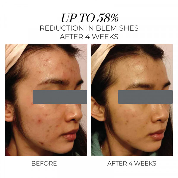 violet-water-hydra-gel