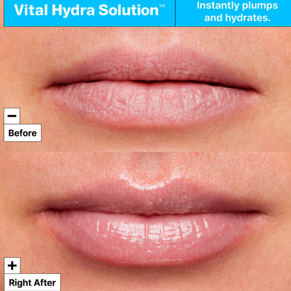 hydra-solution-lip-mask-lip-mask