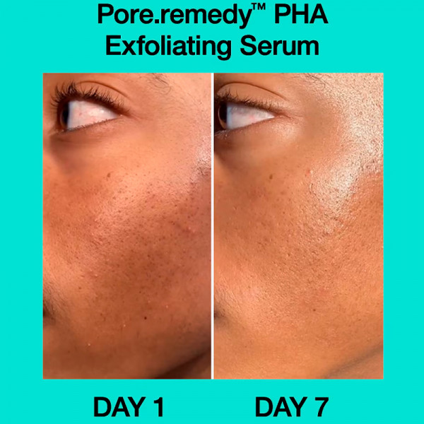 pore-remedy-pha-exfoliating-serum-pha-peeling-serum