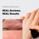 caracol-avancado-96-mucin-power-essence-tratamento-regenerativo-anti-rugas