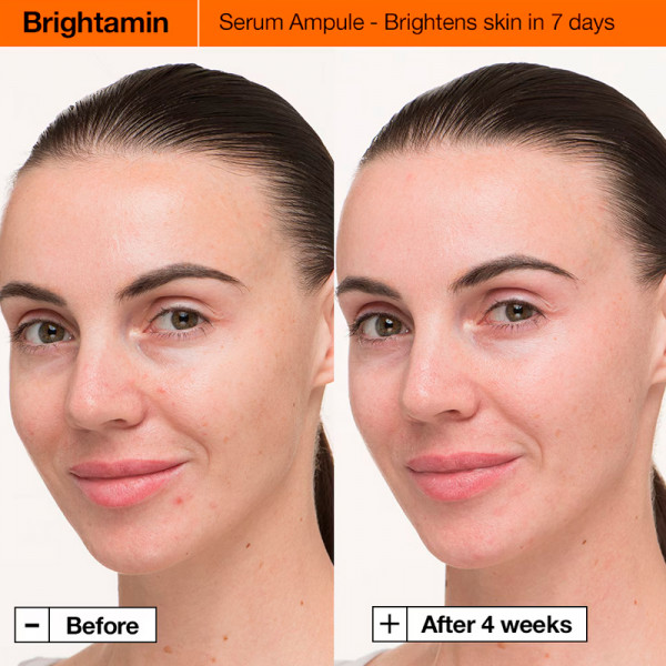 brightamin-brightening-serum-serum-mit-niacinamid-und-vitamin-c
